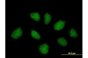 Immunofluorescence of purified MaxPab antibody to C1orf164 on HeLa cell. (RNF220 antibody  (AA 1-566))