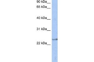WB Suggested Anti-ATP6V1E2 Antibody Titration: 0. (ATP6V1E2 antibody  (Middle Region))