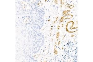 Immunohistochemistry of paraffin-embedded human colon using Decorin Rabbit pAb (ABIN3022360, ABIN3022361, ABIN3022362, ABIN1512816 and ABIN6218761) at dilution of 1:50 (40x lens). (Decorin antibody  (AA 31-359))