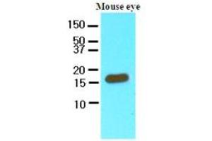 Western Blotting (WB) image for anti-Cellular Retinoic Acid Binding Protein 2 (CRABP2) (AA 1-138), (N-Term) antibody (ABIN356225) (CRABP2 antibody  (N-Term))