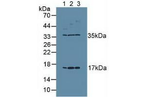 Western blot analysis of (1) Human Placenta Tissue, (2) Human PC-3 Cells and (3) Human MCF7 Cells. (Ki-67 antibody  (AA 3088-3235))
