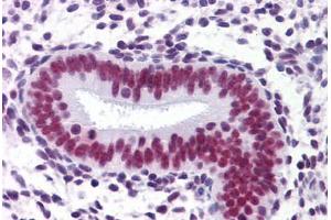 Uterus: Formalin-Fixed, Paraffin-Embedded (FFPE) (CHD4 antibody  (AA 1632-1731))