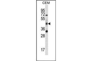 Western blot analysis of RBM42 Antibody (C-term) in CEM cell line lysates (35ug/lane). (RBM42 antibody  (C-Term))