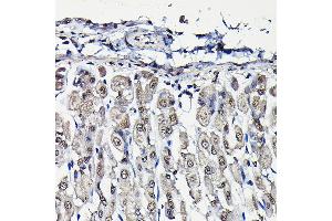 Immunohistochemistry of paraffin-embedded mouse stomach using PFKFB3 Rabbit pAb (ABIN6129841, ABIN6145485, ABIN6145487 and ABIN6222692) at dilution of 1:25 (40x lens). (PFKFB3 antibody  (AA 400-500))