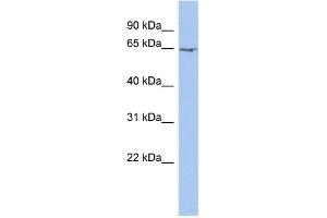 WB Suggested Anti-MYEF2 Antibody Titration:  0. (MYEF2 antibody  (N-Term))