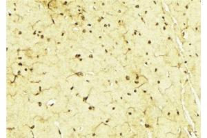 ABIN6268965 at 1/100 staining Mouse brain tissue by IHC-P.