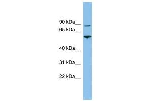 VPS52 antibody used at 1 ug/ml to detect target protein.