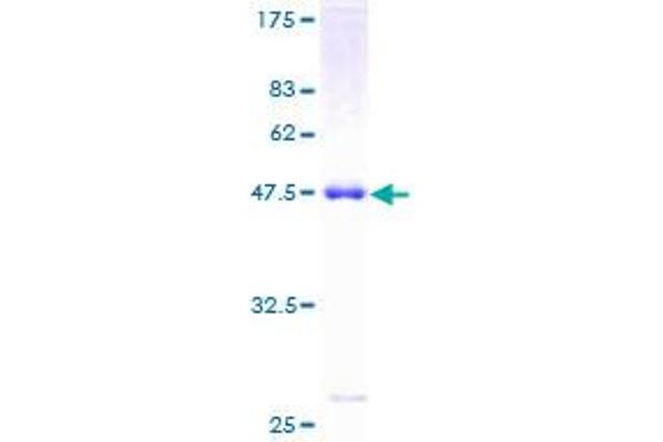 OSTF1 Protein (AA 1-217) (GST tag)