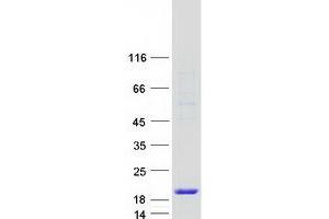Validation with Western Blot