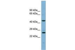 Image no. 1 for anti-Vacuolar Protein Sorting 28 (VPS28) (N-Term) antibody (ABIN6741900) (VPS28 antibody  (N-Term))