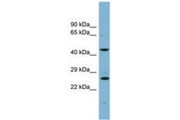 VPS28 antibody  (N-Term)