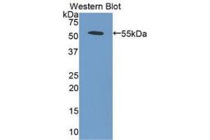 Western blot analysis of the recombinant protein. (BMP5 antibody  (AA 317-454))