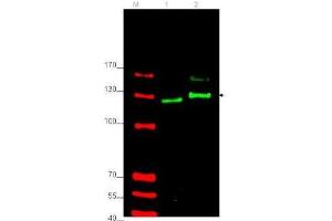 Western blot using  affinity purified anti-Gli-2 antibody shows detection of Gli-2 protein in rat testes (lane 1) and human HEK293 (lane 2) whole cell lysates (arrowhead). (GLI2 antibody  (Internal Region))