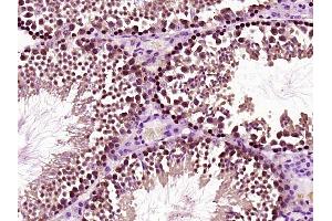 Paraformaldehyde-fixed, paraffin embedded Mouse testis; Antigen retrieval by boiling in sodium citrate buffer (pH6) for 15min; Block endogenous peroxidase by 3% hydrogen peroxide for 30 minutes; Blocking buffer (normal goat serum) at 37°C for 20min; Antibody incubation with HOXC5 Polyclonal Antibody, Unconjugated (bs-11589R) at 1:200 overnight at 4°C, followed by a conjugated secondary and DAB staining. (Homeobox C5 antibody  (AA 151-222))