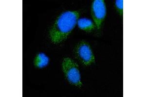 IF analysis of ALAS2/ASB using anti-ALAS2/ASB antibody (ABIN7599056). (ALAS2 antibody  (AA 1-190))