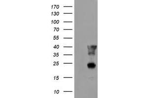 HEK293T cells were transfected with the pCMV6-ENTRY control (Left lane) or pCMV6-ENTRY PECI (Right lane) cDNA for 48 hrs and lysed. (PECI/ECI2 antibody)