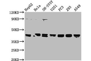 Western Blot Positive WB detected in: HepG2 whole cell lysate, Hela whole cell lysate, SH-SY5Y whole cell lysate, U251 whole cell lysate, PC-3 whole cell lysate, 293 whole cell lysate, A549 whole cell lysate All lanes: TPST1 antibody at 1:2000 Secondary Goat polyclonal to rabbit IgG at 1/50000 dilution Predicted band size: 43 kDa Observed band size: 43 kDa