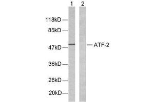 Western blot analysis of extracts from LOVO cells using ATF-2(Ab-69 or 51) antibody (E021030). (ATF2 antibody)
