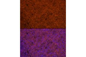 Immunofluorescence analysis of Human spleen using CCL5/RANTES antibody (ABIN6129369, ABIN6138063, ABIN6138065 and ABIN6218473) at dilution of 1:100. (CCL5 antibody  (AA 24-91))