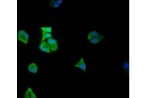 Immunofluorescence staining of Hela Cells with ABIN7127469 at 1:50, counter-stained with DAPI. (Recombinant EIF5A antibody)