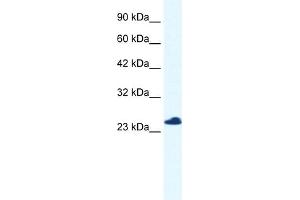 C14orf166 antibody  (N-Term)