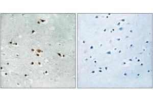 Immunohistochemistry analysis of paraffin-embedded human brain, using FER (Phospho-Tyr402) Antibody. (FER antibody  (pTyr402))