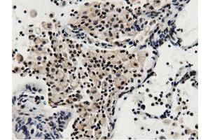 Immunohistochemical staining of paraffin-embedded Human colon tissue using anti-BTN1A1 mouse monoclonal antibody.