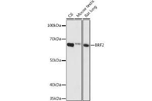 Western blot analysis of extracts of various cell lines, using BRF2 antibody (ABIN6129998, ABIN6137657, ABIN6137658 and ABIN6224790) at 1:1000 dilution. (BRF2 antibody  (AA 1-120))
