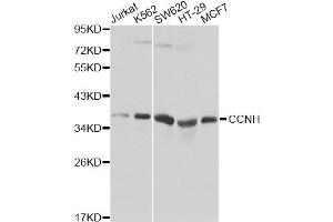 Western blot analysis of extracts of various cell lines, using CCNH Antibody (ABIN5970383). (Cyclin H antibody)