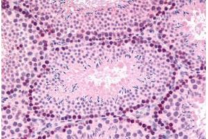 Mouse, Testis (formalin-fixed, paraffin-embedded) stained with GLI2 antibody ABIN214612 at 5 ug/ml followed by biotinylated goat anti-rabbit IgG secondary antibody ABIN481713, alkaline phosphatase-streptavidin and chromogen. (GLI2 antibody  (Internal Region))