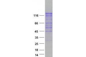 Validation with Western Blot