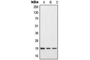Western blot analysis of MMP1 22k expression in MCF7 UV-treated (A), mouse liver (B), rat liver (C) whole cell lysates. (MMP1 22k antibody  (Center))