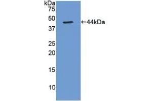 Detection of Recombinant Gastrin, Rat using Polyclonal Antibody to Gastrin (GT) (Gastrin antibody  (AA 1-104))
