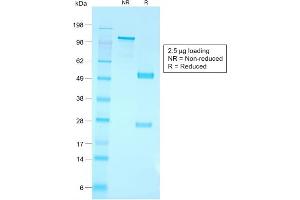 SDS-PAGE (SDS) image for anti-B-cell antigen receptor complex-associated protein alpha chain (CD79A) (AA 202-216) antibody (ABIN6941270)