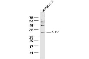 Mouse Spinal cord lysates probed with KLF7 Polyclonal Antibody, Unconjugated  at 1:300 dilution and 4˚C overnight incubation. (KLF7 antibody  (AA 131-210))