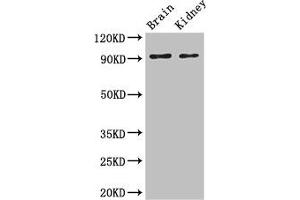 Western Blot Positive WB detected in: Mouse brain tissue, Mouse kidney tissue All lanes: SLC9A1 antibody at 3 μg/mL Secondary Goat polyclonal to rabbit IgG at 1/50000 dilution Predicted band size: 91, 62 kDa Observed band size: 91 kDa (SLC9A1 antibody  (AA 36-102))
