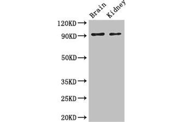 SLC9A1 Antikörper  (AA 36-102)