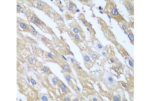 Immunohistochemistry of paraffin-embedded Human liver using PPP4R1 Polyclonal Antibody at dilution of 1:100 (40x lens). (PPP4R1 antibody)