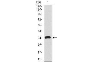 Western blot analysis using CD59 mAb against human CD59 recombinant protein.