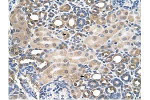 HFE antibody was used for immunohistochemistry at a concentration of 4-8 ug/ml to stain Epithelial cells of renal tubule (arrows) in Human Kidney. (HFE antibody  (C-Term))