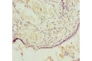 Immunohistochemistry of paraffin-embedded human placenta tissue using ABIN7164067 at dilution of 1:100 (POU4F3 antibody  (AA 1-180))