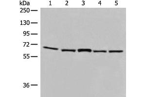 Western blot analysis of TM4 and 231 cell Mouse brain tissue Hela and HT-29 cell lysates using EHD1 Polyclonal Antibody at dilution of 1:500 (EHD1 antibody)