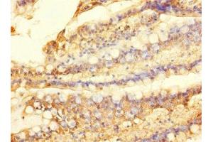 Immunohistochemistry of paraffin-embedded human small intestine tissue using ABIN7170032 at dilution of 1:100 (SLC28A1 antibody  (AA 1-80))