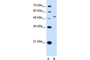 Western Blotting (WB) image for anti-Potassium Voltage-Gated Channel, Shaw-Related Subfamily, Member 1 (KCNC1) antibody (ABIN2462986) (KCNC1 antibody)