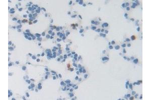 Detection of LRRC32 in Rat Lung Tissue using Polyclonal Antibody to Leucine Rich Repeat Containing Protein 32 (LRRC32) (LRRC32 antibody  (AA 162-405))