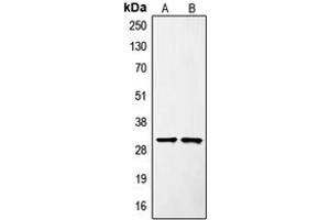 Western blot analysis of SURF1 expression in Jurkat (A), mouse liver (B) whole cell lysates. (SURF1 antibody  (Center))