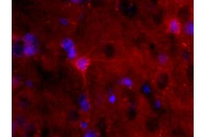 Formalin-fixed and paraffin-embedded rat brain labeled with Anti-S100B Polyclonal Antibody, Unconjugated (ABIN676703) 1:200, overnight at 4°C, The secondary antibody was Goat Anti-Rabbit IgG, PE conjugated used at 1:200 dilution for 40 minutes at 37°C. (S100B antibody  (AA 31-92))