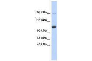 Image no. 1 for anti-U2-Associated SR140 Protein (SR140) (AA 755-804) antibody (ABIN6740720) (SR140 antibody  (AA 755-804))