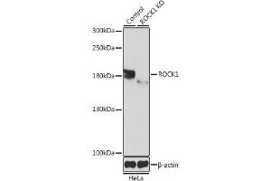 Western blot analysis of extracts from normal (control) and ROCK1 knockout (KO) HeLa cells using ROCK1 Polyclonal Antibody at dilution of 1:1000. (ROCK1 antibody)