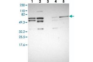 Western blot analysis of Lane 1: RT-4, Lane 2: U-251 MG, Lane 3: Human Plasma, Lane 4: Liver, Lane 5: Tonsil with C14orf133 polyclonal antibody . (VIPAR antibody)